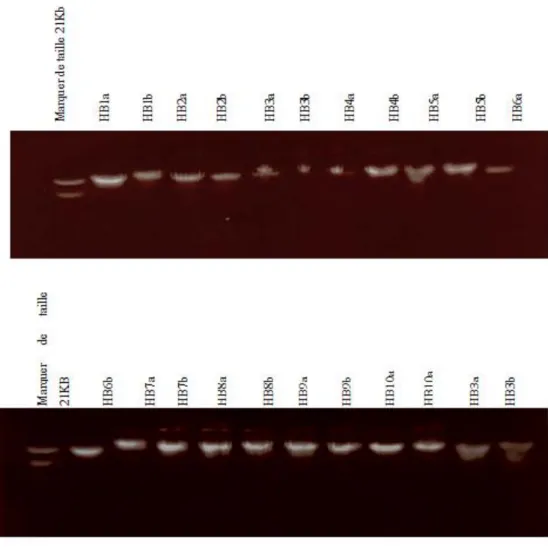 Figure 7 : Analyse électrophorétique de l’ADN pour enrichissement
