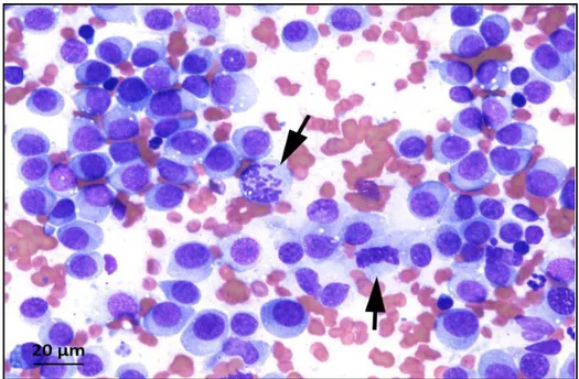 Figure 07 : Aspect cytologique de la tumeur vénérienne transmissible canine  (Laboratoire d'anatomo-cytopathologie, BioPôle Alfort, EnvA)
