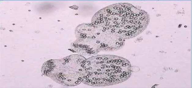 Figure  8: Protoscolex (Sebai et al.,2005) 