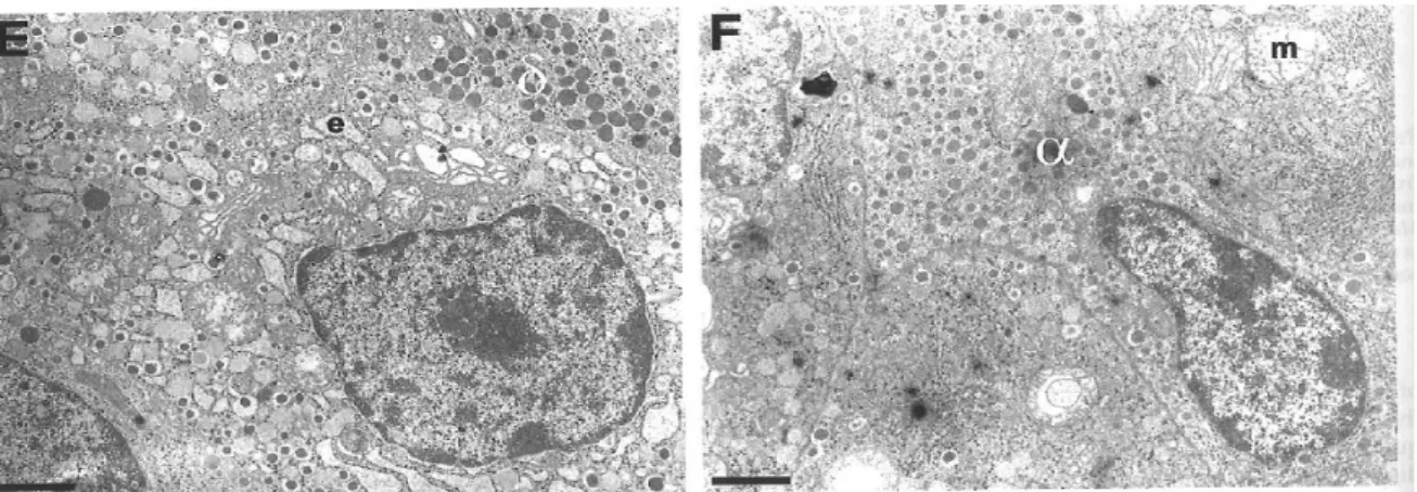Figure 17 : Ultrastructure des cellules endocrines des souris transgéniques surexprimant le gène HNF1A  humain muté en microscopie électronique [76]