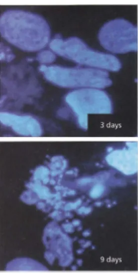 Figure 1.4 – Des cellules réagissent à un traitement cytotoxique : on observe ici les noyaux de cellules touchées par la molécule