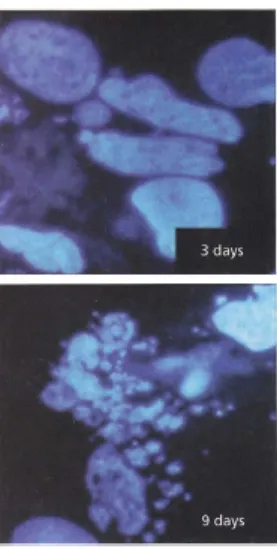 Figure 1.4 – Des cellules réagissent à un traitement cytotoxique : on observe ici les noyaux de cellules touchées par la molécule