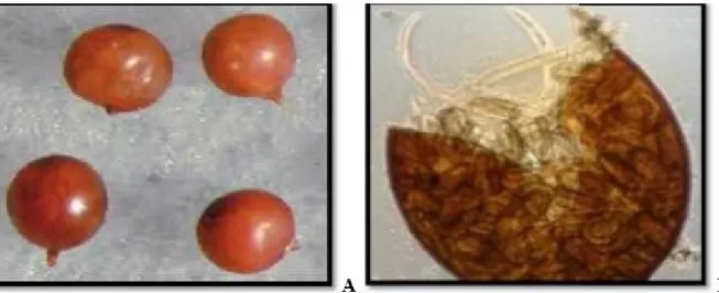 Figure 8 : Description morphologique de Globodera (A) kyste de Globodera sp. (B) kyste  ouvert de Globodera sp (LNPV, 2013)