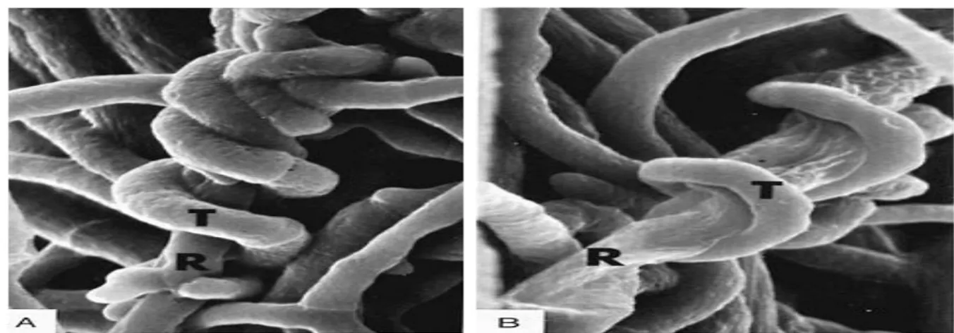 Figure 04. Mycoparasitisme chez le Trichoderma sp. (Source Agrios, 2005).  