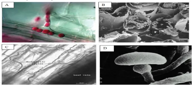 Figure 1 : Illustrations microscopiques de quelques champignons endophytes. 