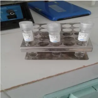 Fig. 11: Tube de phosphore total (laboratoire de STEP de BBA., 2017).  II.3.9. Dosage d’azote total  