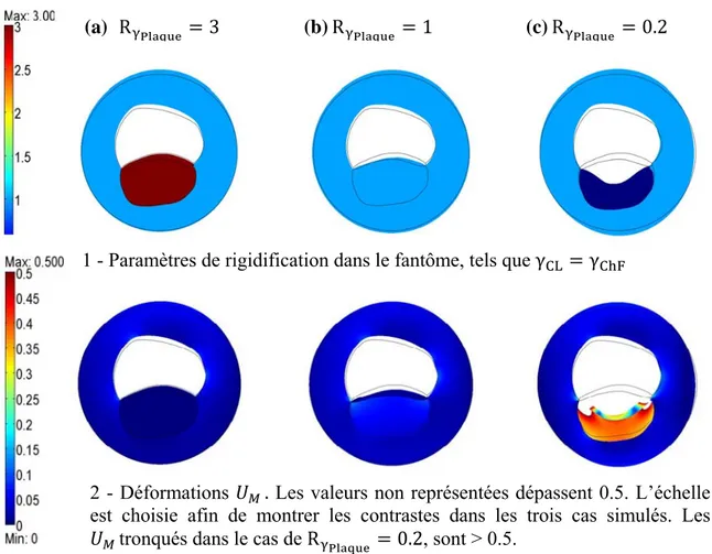 Figure 3-5 : Effets d’une variation des rapports des paramètres de rigidification sur les déformations de la plaque dans le fantôme artériel