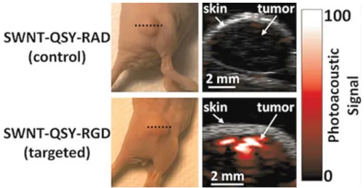 Figure 2-6: Imagerie photoacoustique de tumeurs chez deux souris avec une sonde à base de  nanotubes de carbone
