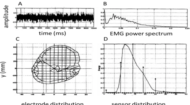 Figure 2.20: A: EMG signal; B: power spectrum of the signal C: Estimated source location (small  dot)  in  the  upper  arm  model  created  from  a  MRI  image