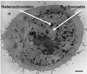 Figure  14:  Human  HeLa  cell  observed  by  electron  microscopy.  Heterochromatin  (dark 