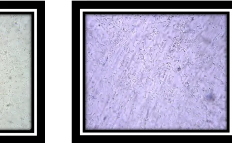 Figure 13: Aspect microscopique  des lactobacilles et les lactocoques à l‟état frais (G×40)