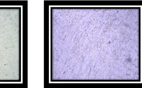 Figure 13: Aspect microscopique  des lactobacilles et les lactocoques à l‟état frais (G×40)