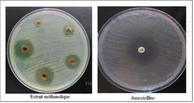 Figure 08 : Zones d’inhibition de la croissance de Staphylococcus aureus induites par 