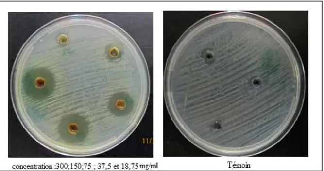 Figure 09: Inhibition de  la croissance de Staphylococcus aureus vis -à- vis les concentrations 