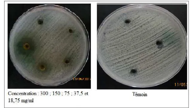 Figure 11: Inhibition de  la croissance de Bacillus cereus par les concentrations de l’extrait 