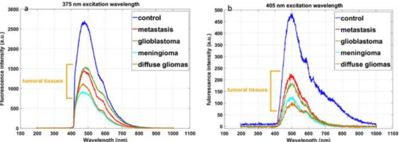 Figure 2-8: Fluorescence of different types of tumor and of control tissue (epileptic) with  excitation at 375 nm and 405 nm [4]