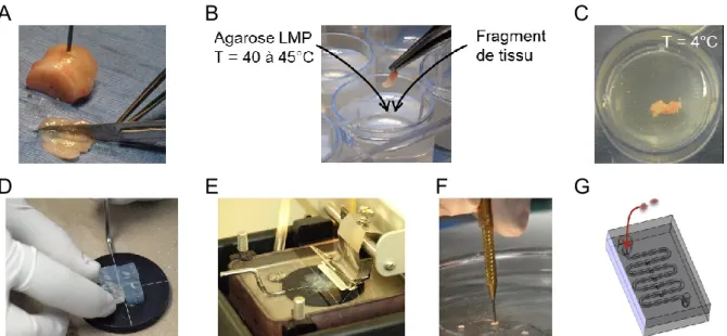 Figure  2.1:  Procédure  de  découpe  du  tissu  cancéreux  pour  l’insertion  dans  les  systèmes  microfluidiques