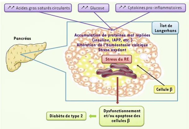 Figure 3 : Pathogenèse du diabète de type 2 en relation avec le stress du réticulum endoplasmique