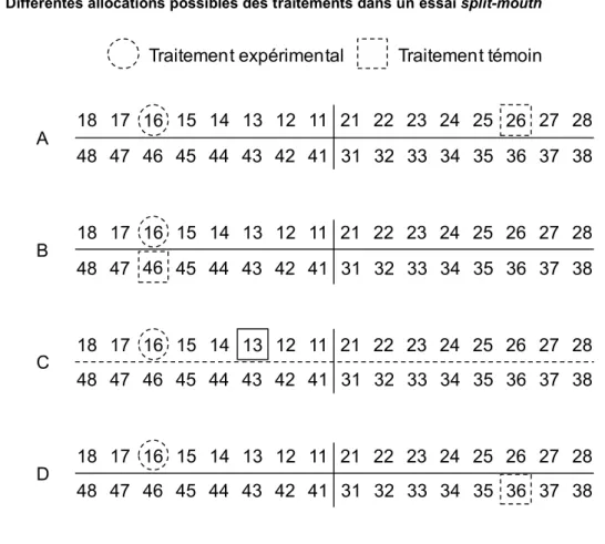 Figure 3: Différentes allocations possibles des traitements dans un essai split-mouth 