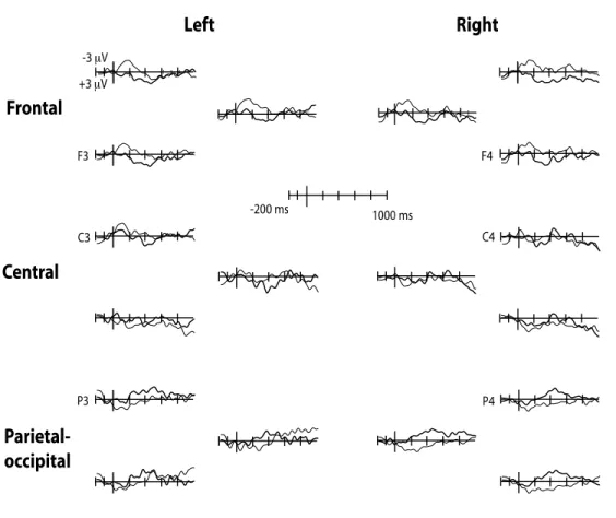 Fig. 3. Grand-averaged waveforms for related (thin line) and unrelated (thick line) target words in 24-month-old 