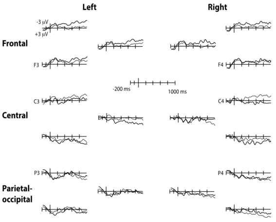Fig. 4. Grand-averaged waveforms for related (thin line) and unrelated (thick line) target words in 18-month-old 