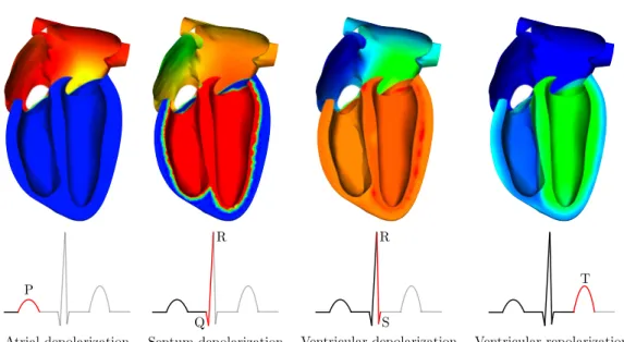 Figure 1.10: First lead waves generation.