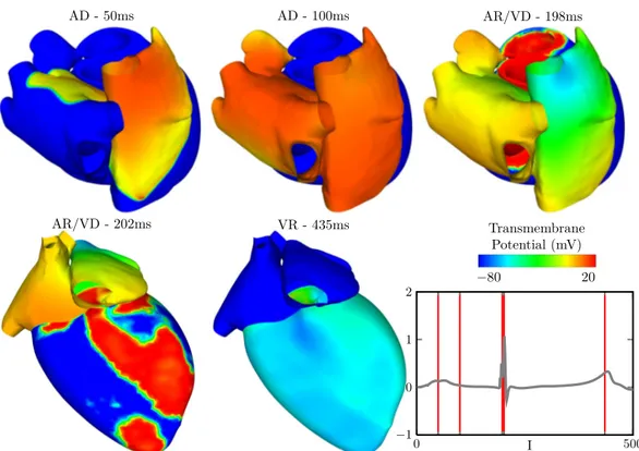 Figure 2.5: Simulations of heart depolarization in a healthy case with the corre- corre-sponding electrocardiogram ﬁrst lead.