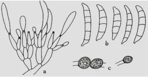 Figure 3 : Caractéristiques de Fusarium culmorum (Botton el al., 1985), (x750) . 