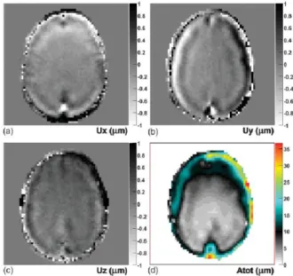 Figure 1-1-1 : Figure 1 - displacement ﬁeld components of the brain in the x, y and z directions  (a, b and c) in micrometres at an arbitrary time point for an in vivo dataset