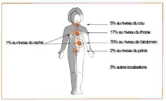 Figure 14 : Localisation des neuroblastomes. 