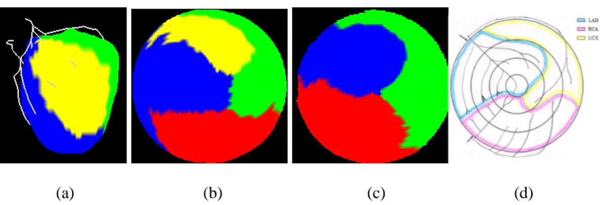 Figure 7 : Territoires pour le Patient 1 en 3D et sur une carte 2D avec quatre groupes de  coronaires (a,b) et pour le patient 2 selon notre méthode (c) comparé au résultat de la 