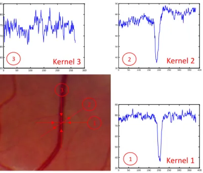 Figure 4-1. Retinal blood vessel (a) and the intensity profile of its cross section for different ori- ori-entations  
