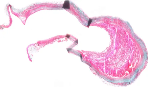 Figure 2. Image de thrombus anévrysmal dans un modèle d’anévrysme sacciforme par xénogreffe chez le rat