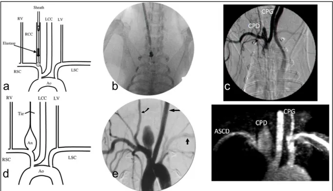 Figure 10: Modèle anévrysmal à l’elastase chez le lapin. Un désilet est inséré de façon rétrograde dans la RCC  et un cathéter à ballon est inséré via le désilet et gonflé à l’origine de la RCC (a et b)