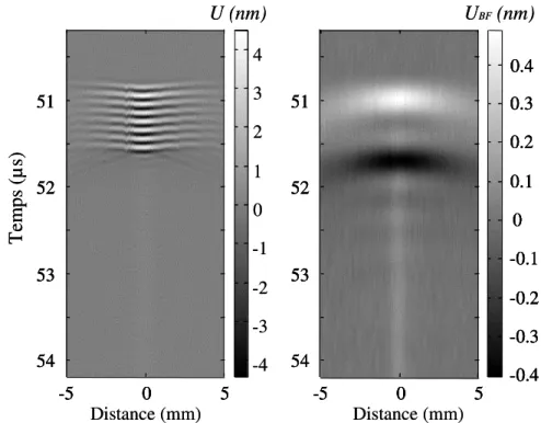 Figure 2.13 : Représentations spatio-temporelles du déplacement du train d’ondes U  (a) et de sa composante de  basse fréquence U BF   (b) mesurés au foyer d’un transducteur focalisé