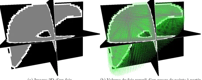 Figure 4.1 Reconstruction 3D d’un foie à partir d’images 2D d’un scanneur