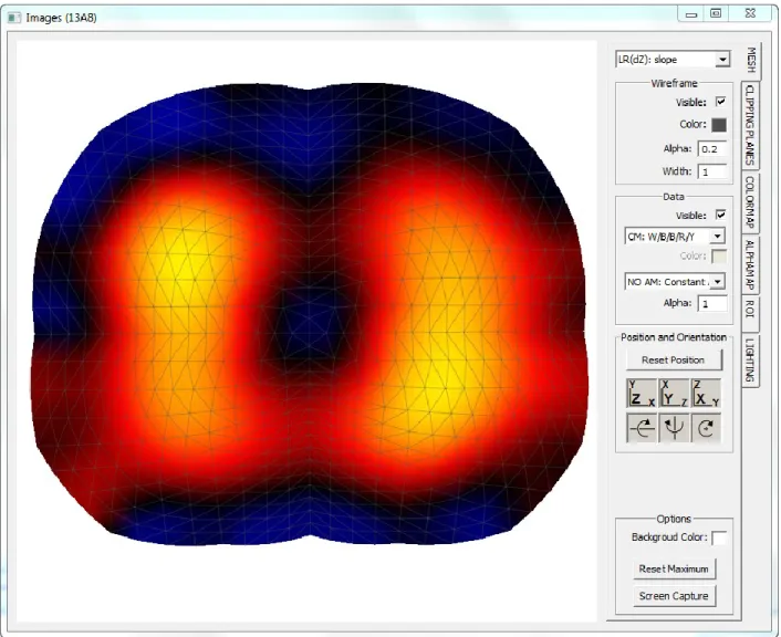 Figure 3-2: Interface graphique du module EnhancedMeshViewer. 