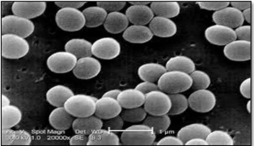 Figure 01 : Observation de S. aureus sous microscope électronique à balayage au 