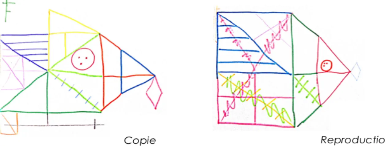 Illustration  1 :  Production  à  la  Figure  Complexe  de  Rey  d’une  patiente  adolescente  hospitalisée pour AM sévère