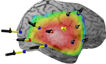 Figure 3.8 Exemple de neuronavigation : les sources sont repr´esent´ees par les points rouges et les d´etecteurs par les points bleus