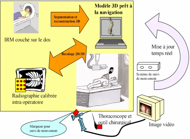 Figure 3.1 : Approche globale du projet 