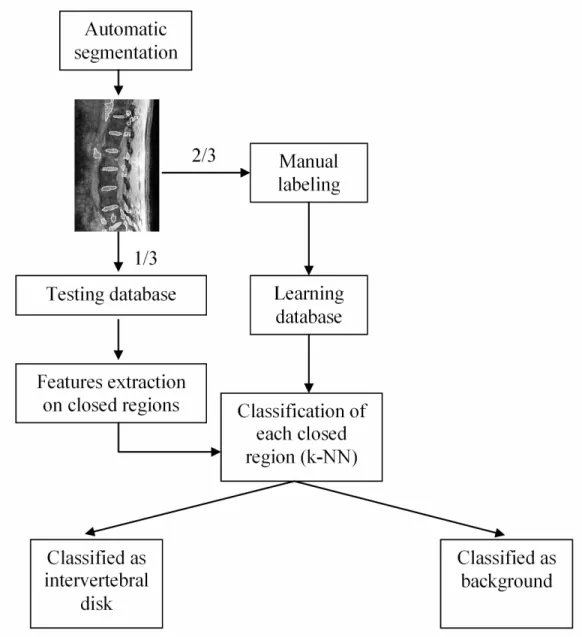 Figure  4.1 :  Workflow  of  the  steps  involved  in  the  classification  of  closed  regions  resulting from the automatic segmentation process