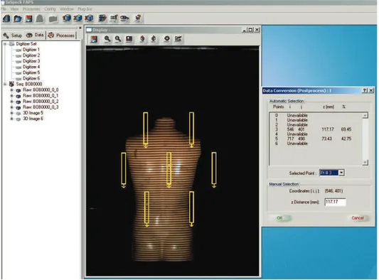 Figure 2.7 Sélection du point de référence pour convertir la profondeur du pixel au mm (logiciel FAPS).