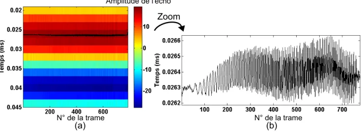 Figure 2.7 : (a) S´ election de l’impulsion correspondant ` a l’´ echo renvoy´ e par le baffle rigide