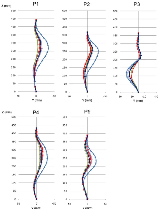 Figure 4.4 Article 2 Figure 4 Spine curve of the patients in the coronal plane: Before brace  ( ), In virtual brace, with the flexible spine model, for a strap tension of 20 N ( ) and 60  N ( ), with the stiff spine model, for a strap tension of 20 N ( ) and 60 N ( ), and in the  real brace ( ) 