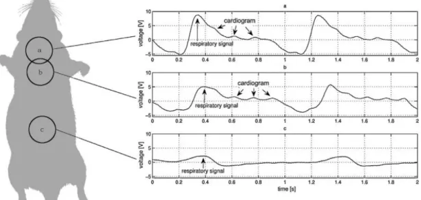 Figure 2-3 : Influence du positionnement du capteur piézoélectrique sur le signal obtenu  ((Herrmann, Pfeiffer, Krumbein, Herrmann, &amp; Reichenbach, 2014) 