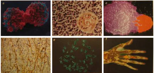 Figure 1. Acquired capabilities of cancer cells: (a) self- self-sufficiency in growth signals; (b) insensitivity to  growth-inhibitory (antigrowth) signals; (c) evasion of programmed cell death (apoptosis); (d) sustained angiogenesis (growth of blood vesse