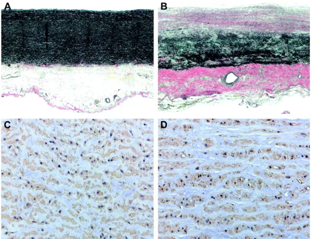 Figure 2.4: In figures A and C, two sections of a non-aneurysmal aortic tissue are compared with images B and D, taken from an aortic aneurysmal tissue