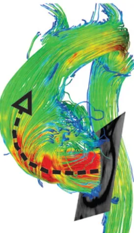 Figure 2.6: In the study by Barker, spectacular reconstructions of the blood flow streamlines were made, confirming Hope’s findings