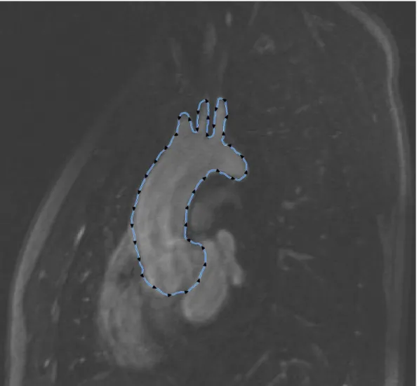Figure 3.2: One of the slices used for the reconstruction is shown. In blue is the segmentation contour made with the Snake feature